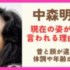 中森明菜の現在が別人と言われる理由４選！昔と顔が違うのは体調不良や年齢のせい？