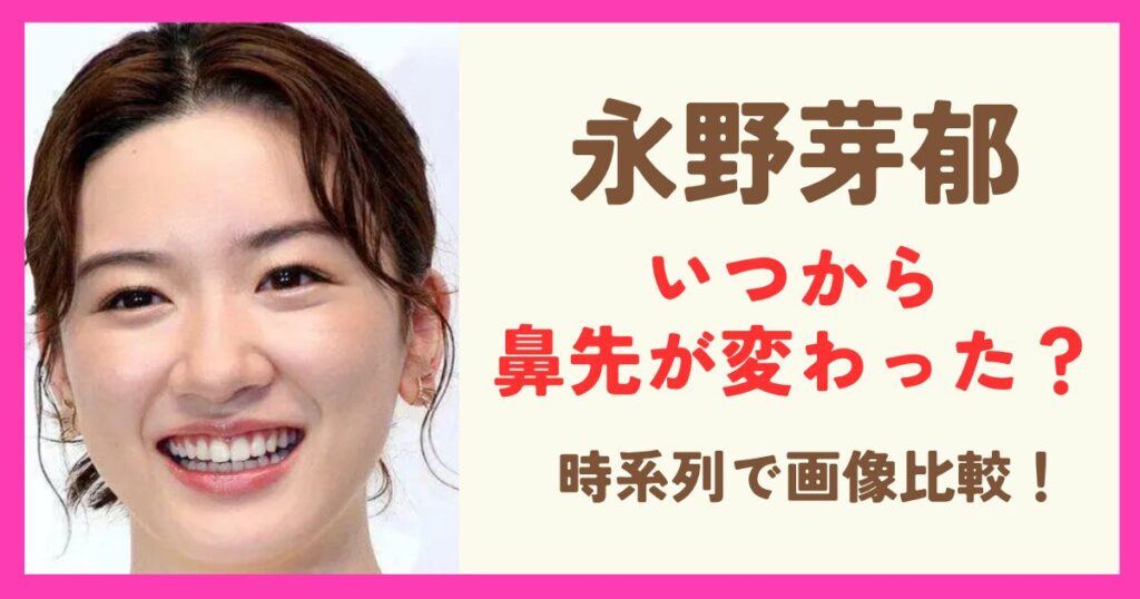 永野芽衣の鼻先変わったのはいつから？時系列で画像比較！