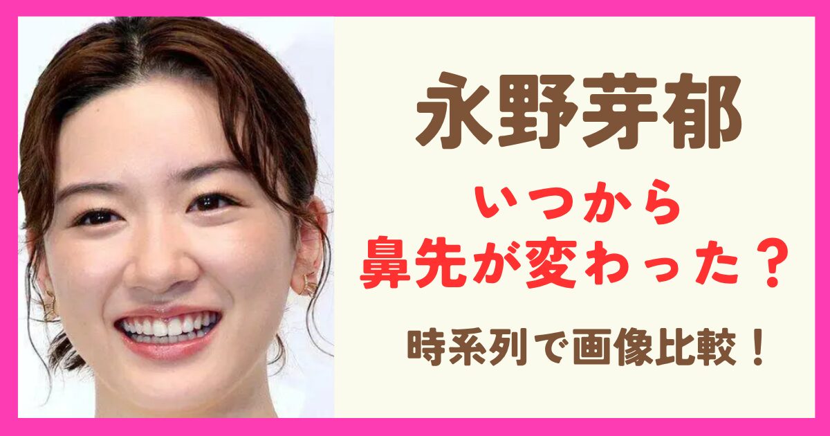 永野芽衣の鼻先変わったのはいつから？時系列で画像比較！