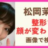 【2025】松岡茉優は整形で顔が変わった？目や表情の変化を画像で検証！